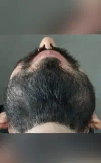 ریشات هنوز در نیومده