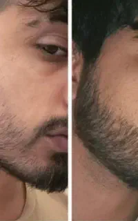 ریشه طلایی