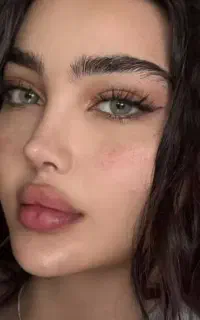 اصلاح فرم بینی ،رینوپلاستی ۲۰۲۶
