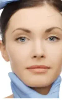 افرویژه ب مناسبت افتتاحیه ژل بوتاکس فیلر