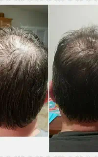 اینجا کاشت ممنوعه چون مشکلتو حل میکنیم