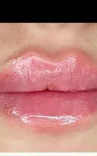 تخفیف ویژه لاین لاغری و زیبایی