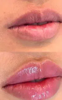 چند مدل برای فیلر هزینه مواد گرفته میشود