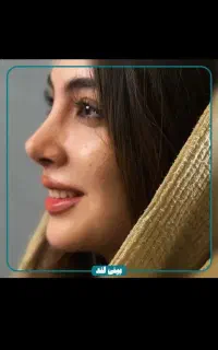 جشنواره عمل بینی