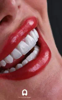ثبت نام(مهلت آخر)آموزش پرسنل دندانپزشکی در ایوان