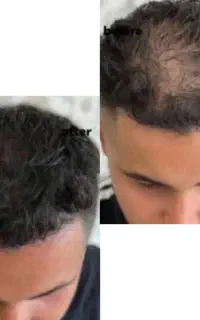 وقت تغییر رسیده با کم پشتی خدافظی کن