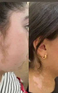 تنها راه نجات از بیماری های پوستی