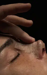 جراحی بینی کلینیک زیبایی رینوپلاستی