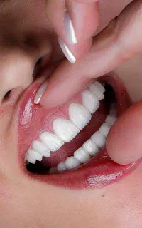 ایمپلنت تخصصی شرایط نقدواقساط/توسط جراحان فک وصورت