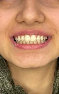 جشنواره عید تا عید مرکز دندانپزشکی ارکیده