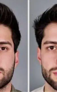 تپل شدن صورت ،کانتورینگ فول فیس اقایون