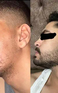 ریش تازه ،مرد تازه