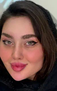 فول فیس خلیجی و ژل لب /بوتاکس/پزشک/تخفیف60 درصدی