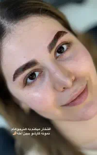 آموزش  تخصصی لیفت باقیمت ویژه
