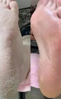 کاشت ناخن و پدیکور پا