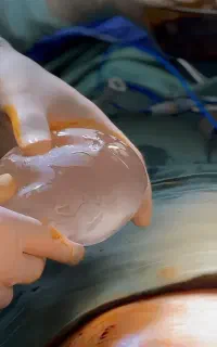جشنواره پیکرتراشی لیپونیوفیس با شرایط اقساطی
