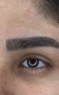مدل برای فیبروز - بن مژه