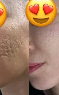 جشنواره تخفیفات کرم های بیوممتیک
