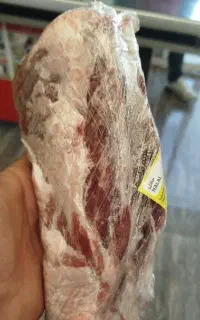 گوشت گردن