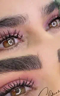 میکروبلیدینگ و فیبروز ابروسبک کرکی مویی سوپرنچرال