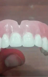 دندانسازی،دندان مصنوعی ،پروتز متحرک