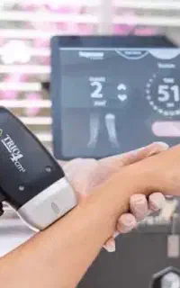 لیزر موهای زائد
