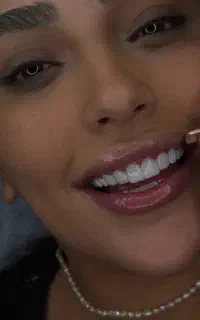 تخفیفات خدمات دندانپزشکی ویژه