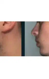 جذاب‌ترین ریش و سیبیل مال خودت کن