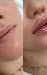 ژل لب عروسکی کره ای