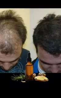 محلول معجزه گر مو ریش