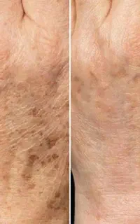 آموزشگاه پاکسازی پوست مو و زیبایی مینا فام