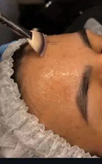 فشیال و پاکسازی