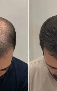 مگه من مرده باشم موهات بریزه