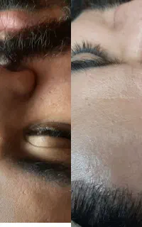 فیشیال و پاکسازی عمیق  صورت