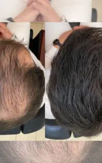 خداحافظ ریزش و کمپشتی