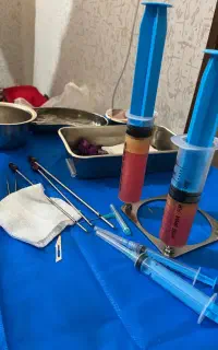 تعویض پانسمان و درمان زخم در منزل