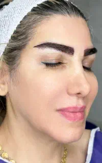 آفر ویژه کاشت ابرومتد فاین برو تضمینی فقط دونفراول