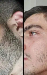 کاشت‌ممنوع