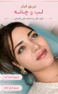 فیلر لب فقط ۱/۳۰۰/۰۰۰(بوتاکس چشم گربه ای رایگان)