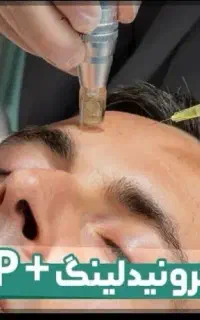 تخفیف ویژه برای پی آر پی‌‌ با بهترین نوع کیت خارجی