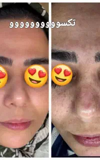 میخای پوستت مثل آیینه شفاف بشه