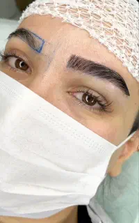 کاشت تخصصی ابرو