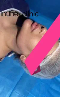 جشنواره لیپوساکشن غبغب