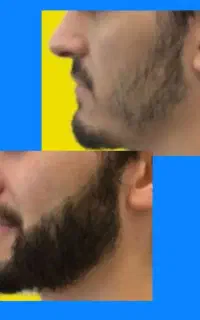 یه سرم تقویت کننده ریش