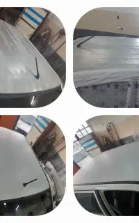 رفع آفتاب سوختگی