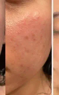 محصولات آرایشی درمانی تراست