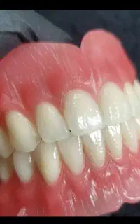دندانسازی محلات تحویل یکروزه