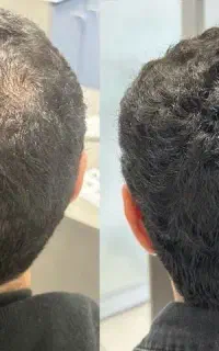 احیای رشد طبیعی