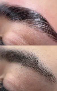 تخفیف خدمات تخصصی لیفت ابرو
