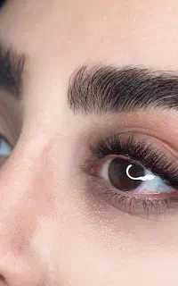 کاشت مژه